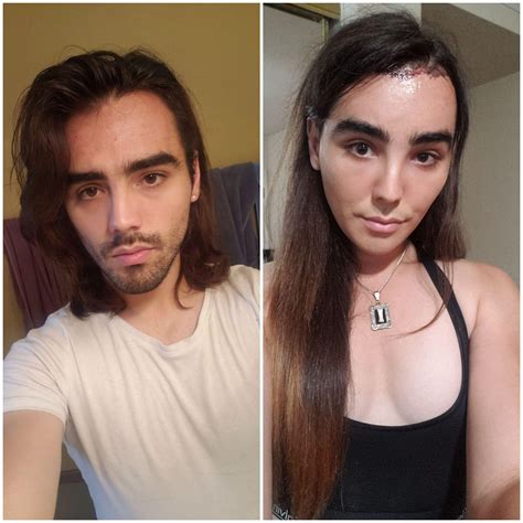 Pre Everything Left Vs 14 Months Hrt And 2 Weeks Post Ffs Right Lowkey Think I Make A Cute