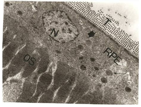 micrograph   retinal pigmented epithelium rpe  light exposure