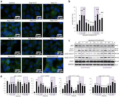 Fine Tuning Of Ampkulk Mtorc Regulatory Triangle Is Crucial For