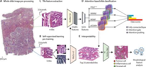 Endometrium Slide