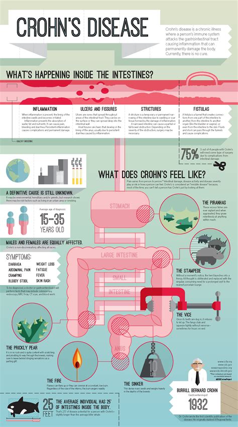 Crohns Disease An Infographic On Behance