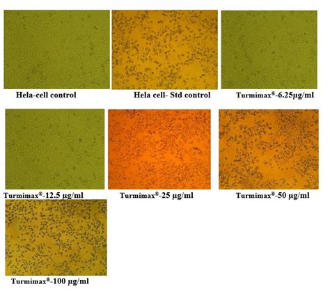 Scielo Brasil Antiproliferative Activity And Apoptosis Inducing