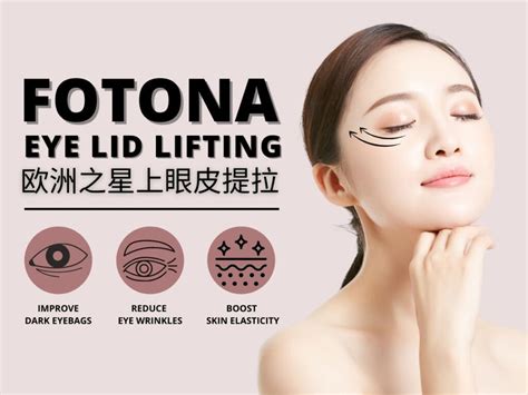 Complete Guide To Fotona Laser Eyelid Lifting In Singapore