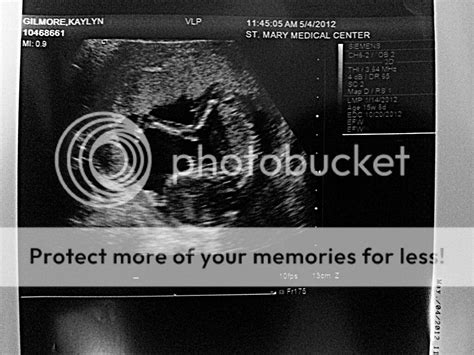 Baby Ultrasound Funny Quotes. QuotesGram