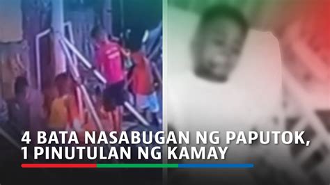 Bata Nasabugan Ng Paputok Sa Maynila Pinutulan Ng Kamay Youtube