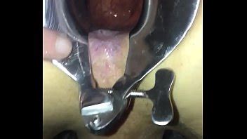 Espéculo y semen XVIDEOS