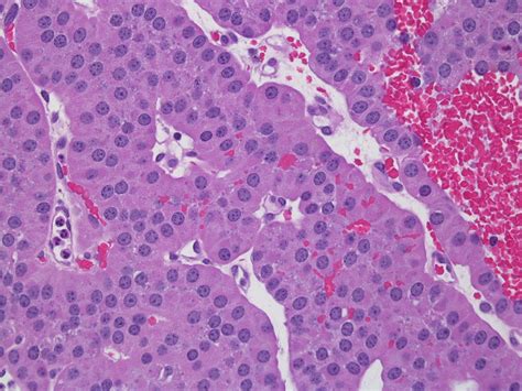 Parathyroid Adenoma : r/Histology