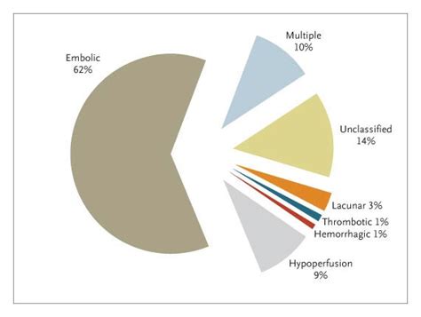 Perioperative Stroke New England Journal Of Medicine