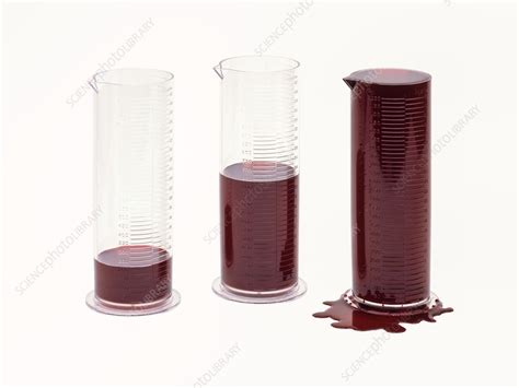 Blood Loss Amounts Stock Image C0096932 Science Photo Library