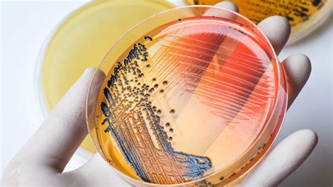 Different types of food contaminants and how to avoid them – Yamato Scale