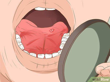 How To Heal A Sore Tongue Steps With Pictures Artofit