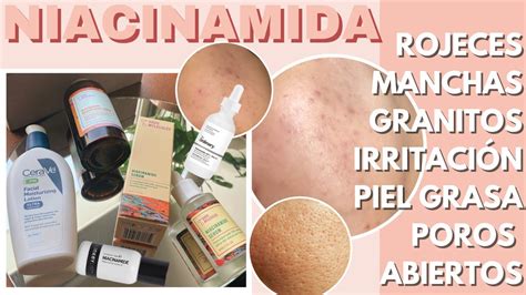 NIACINAMIDA QUÉ ES BENEFICIOS CÓMO USARLA MEZCLAS PRODUCTOS MELI