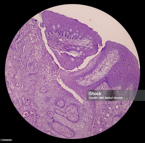 Microscopic Tissue Of Retromolar Region Show Buccal Mucosa Squamous