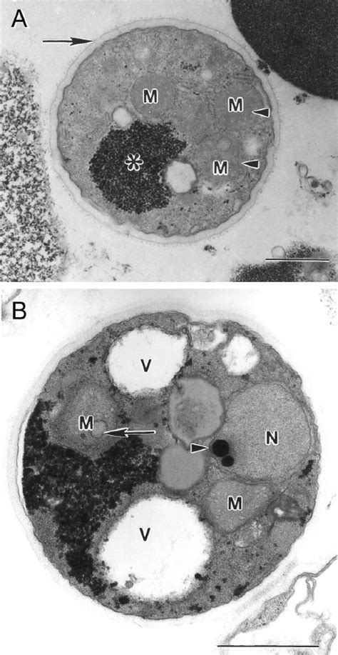 Transmission Electron Micrographs Of Blastocystis Sp Subtype 4 Cysts Download Scientific