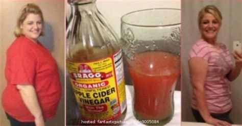 Apple Cider Vinegar Weight Loss Before And After Pictures Bmi Formula