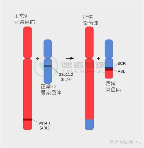 白血病系列之一（白血病机理及分类） 知乎