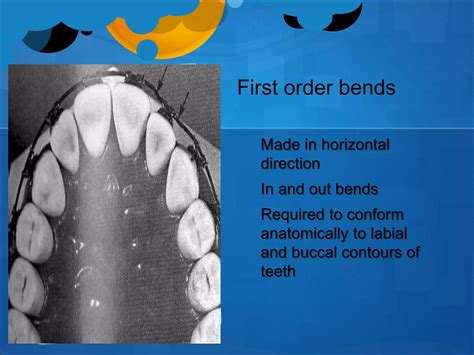 Fixed Orthodontic Appliances Ppt