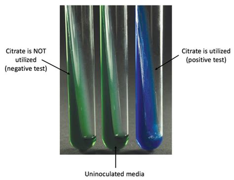 Enterics Selective And Differential Media Citrate And Sim Flashcards