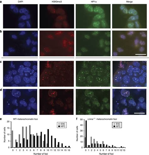 Lmna Npcs Exhibit Abnormal Heterochromatin Structure A B Dapi