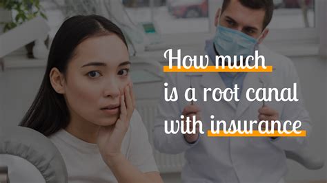 Demystifying Dental Costs How Much Is A Root Canal With Insurance