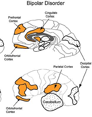 Tag theories for how bipolar disorder works in the brain | Thrive With ...