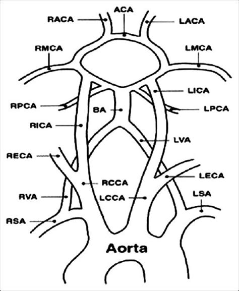 Carotid Anatomy Diagram