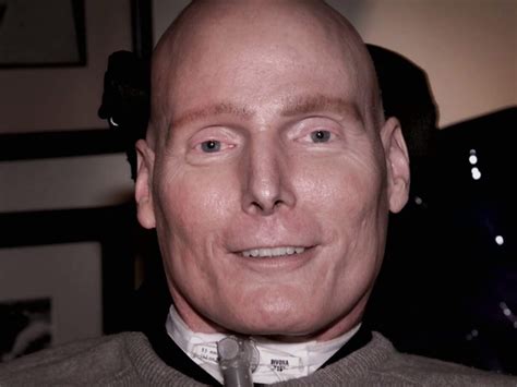 The Importance Of Celebrity Autopsy Photos