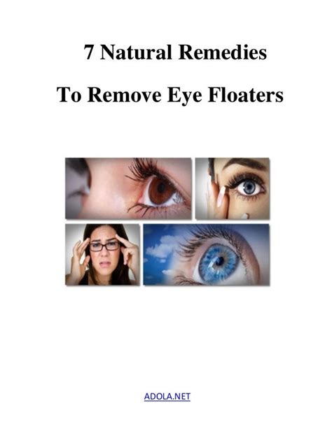 7 Natural Remedies To Remove Eye Floaters