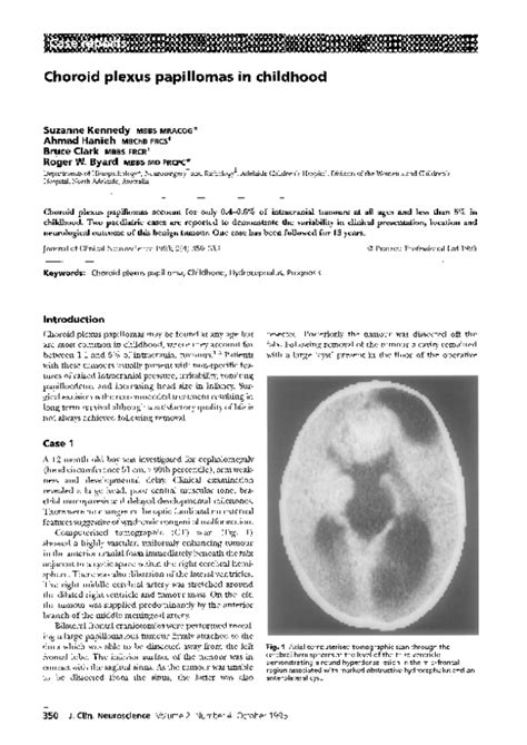 Pdf Choroid Plexus Papillomas In Childhood Roger Byard