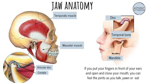 Treating Tmj With Trigger Point Dry Needling Physical 58 Off