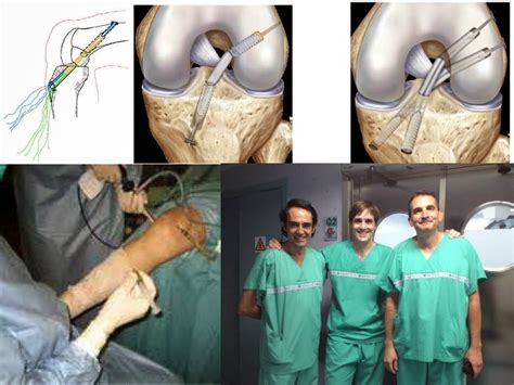 Artroscopia ¿qué Es Y Para Qué Sirve Casaldots