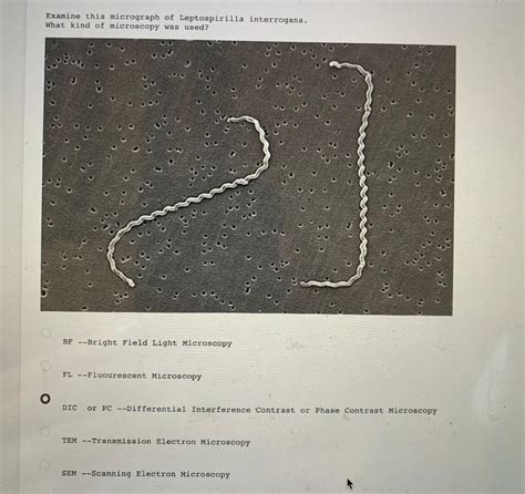 Solved Examine This Micrograph Of An Escherichia Coli Chegg