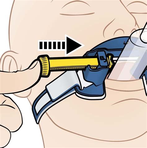 トーマスセレクトチューブホルダーは簡単に装着できます Laerdal Medical