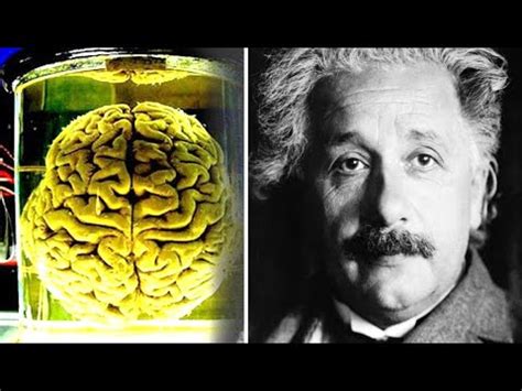 The Sad Story Of How Einsteins Brain Was Stolen Even Though He Gave