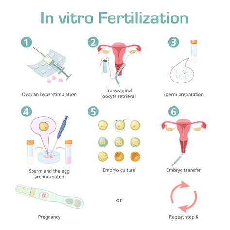 Esco Medical | In vitro fertilization (IVF) as Fertility Treatment