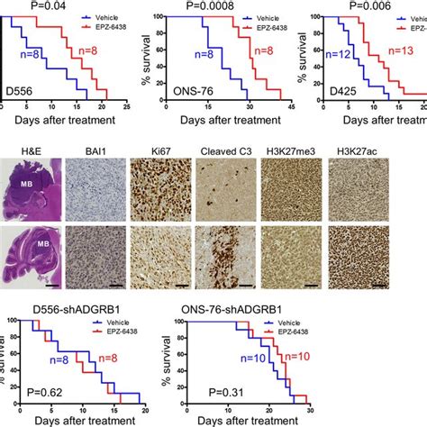 Targeting Ezh2 Blocks Tumor Growth In Orthotopic Mb Models A