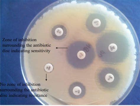 L A B T H O L O G Y On Twitter Examples Of Zone Diameter For Staph