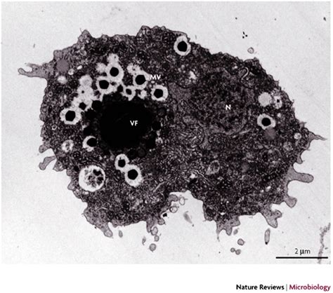 Mimivirus Infecting Acanthamoeba Polyphagatransmission Electron Download Scientific Diagram