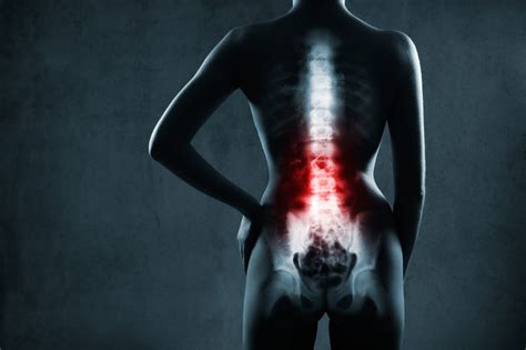 Common Causes of Spinal Injuries - No Blog Title Set