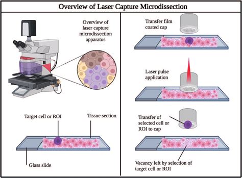 Overview of laser capture microdissection. | Download Scientific Diagram 