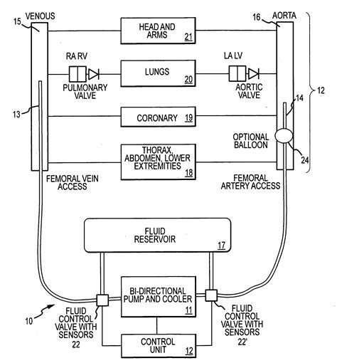 Cardiopulmonary Bypass Devices And Methods Eureka Patsnap