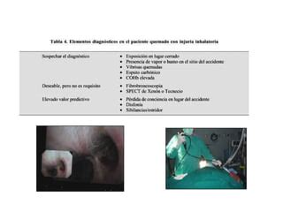 Quemaduras Injuria Inhalatoria Venezuela Ppt