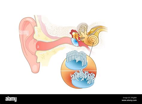 Damaged Cochlear Hair Cells