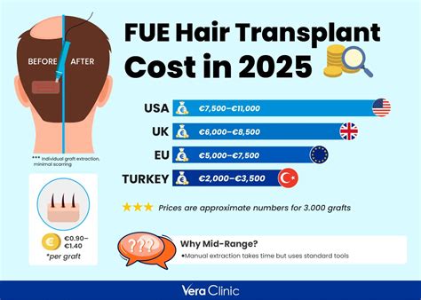 hair transplant cost     hair transplant vera clinic