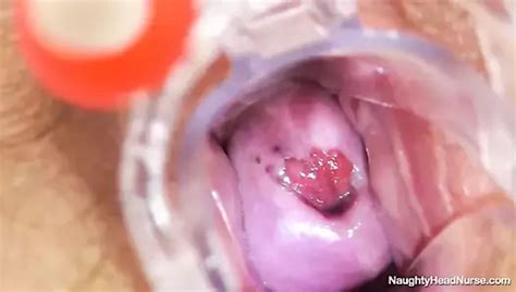 Naughtyheadnurse Porn Videos XHamster