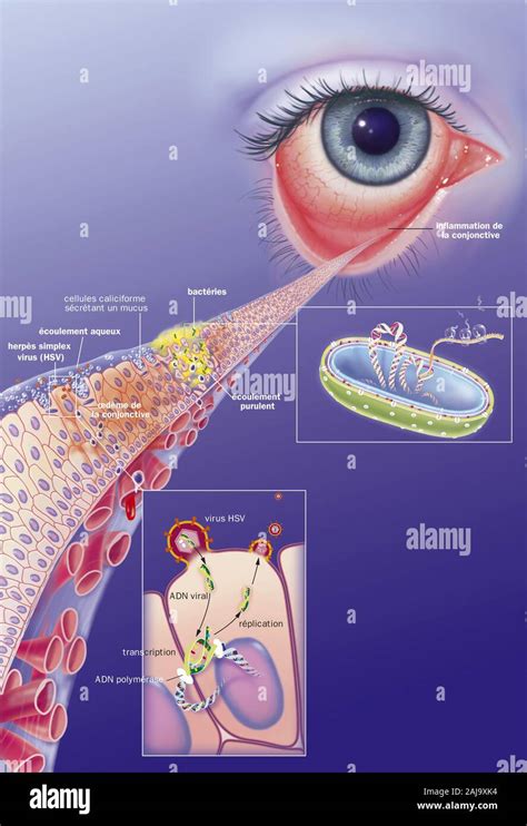 Konjunktivitis -Fotos und -Bildmaterial in hoher Auflösung – Alamy