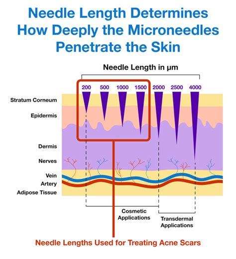 Microneedling And Acne Scars