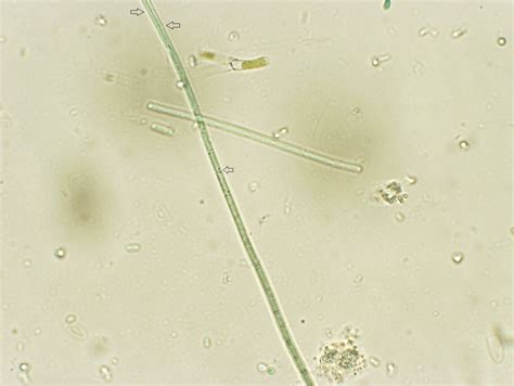 Cyanobacteria Under Microscope