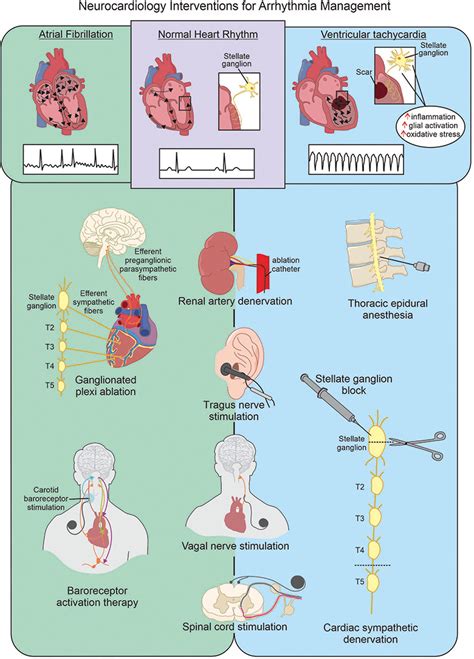 Autonomic Nervous System And Arrhythmias In Structural Heart Disease