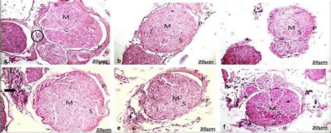 Photomicrographs Of Transverse Sections In The Sciatic Nerve Of Adult